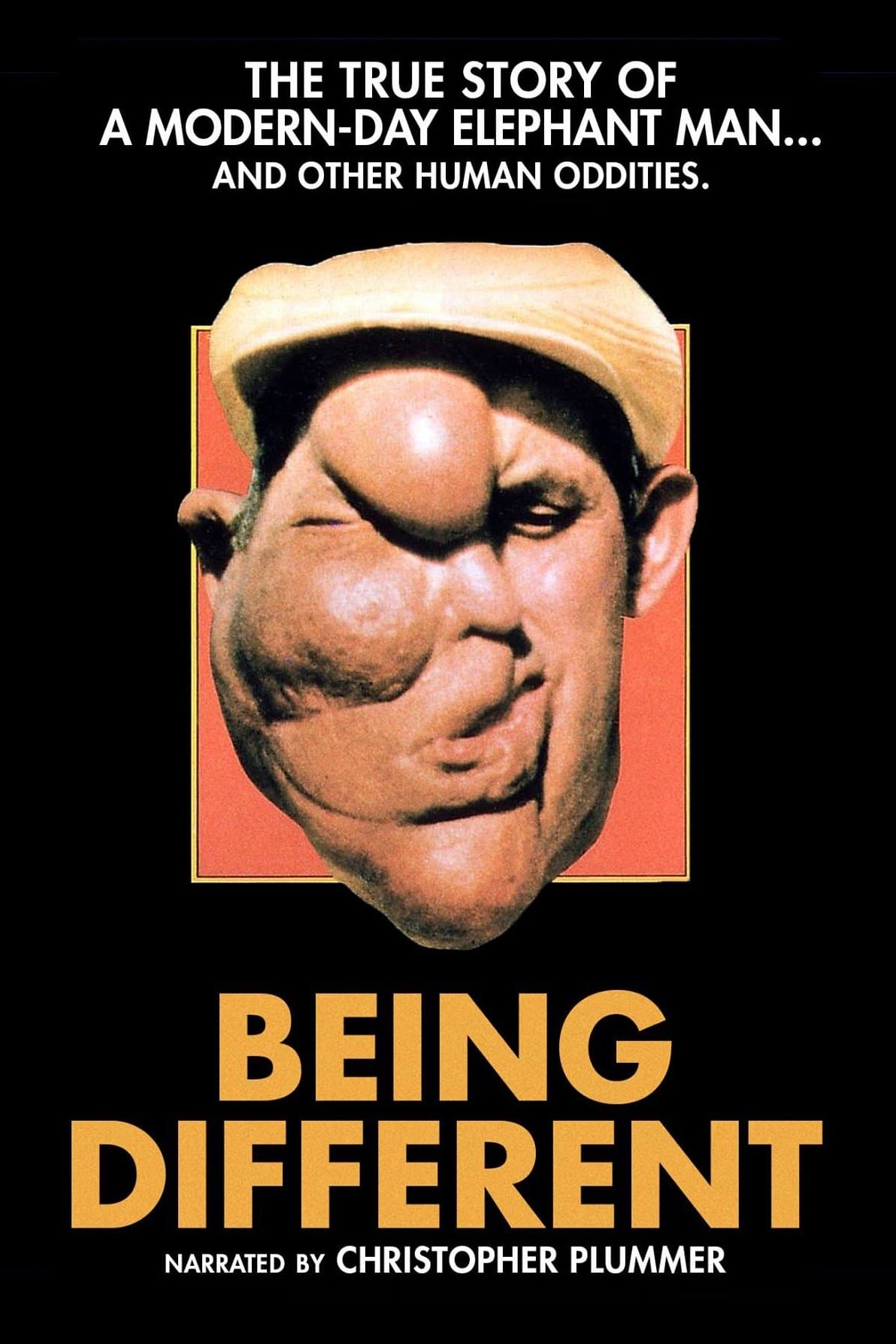 Being Different photo