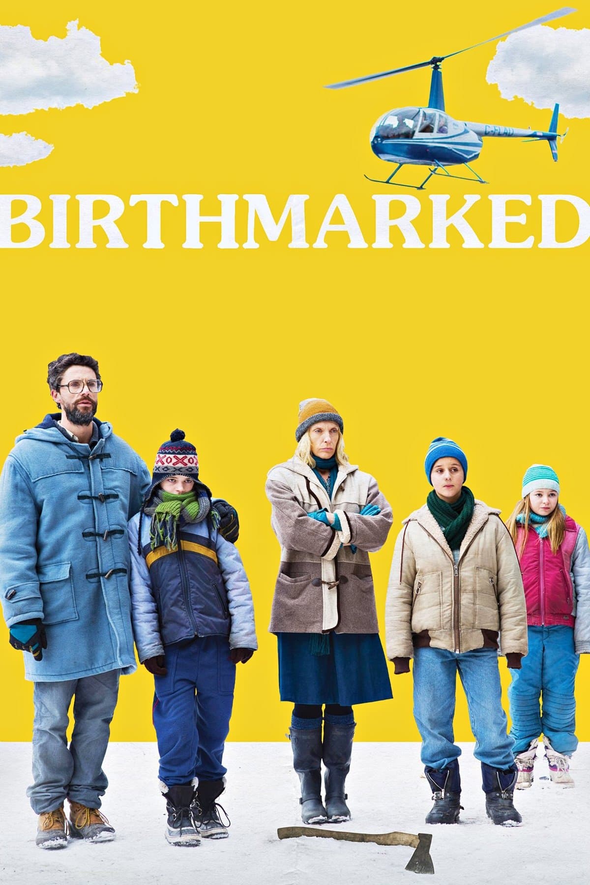 Birthmarked photo