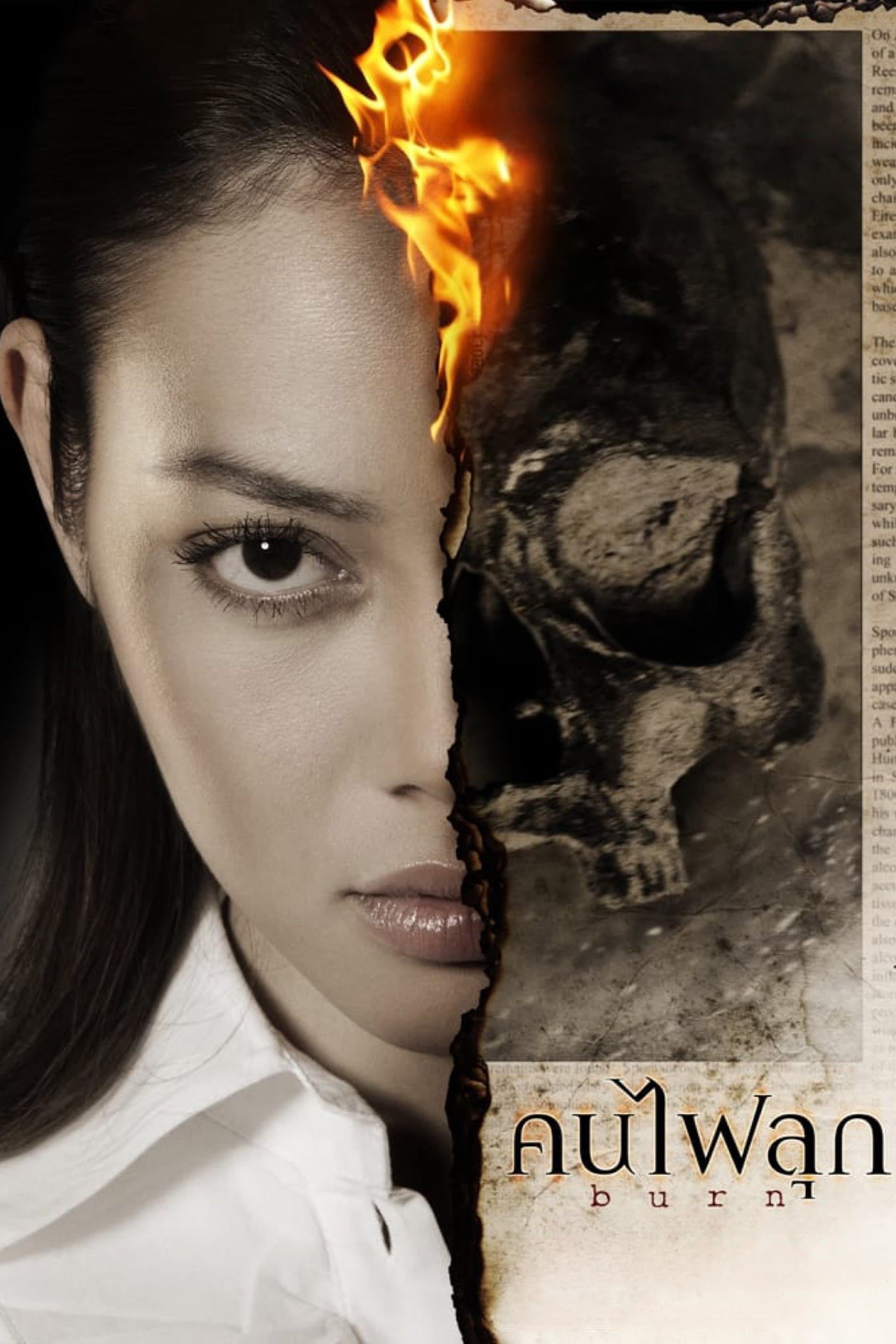 Burn photo