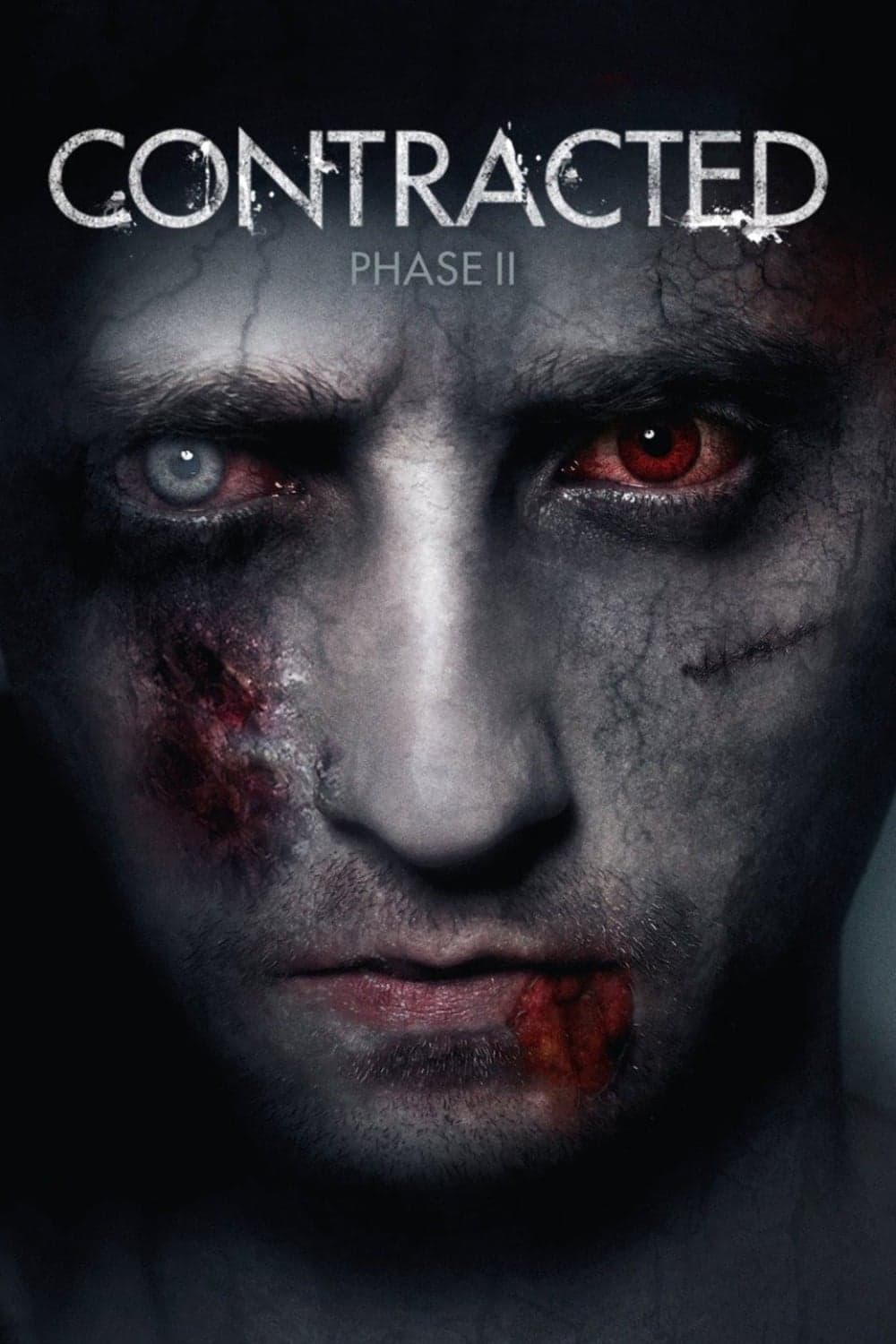 Contracted: Phase II photo