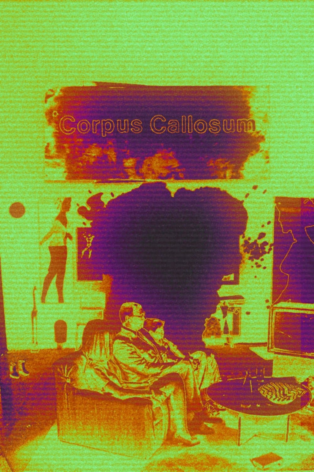 *Corpus Callosum photo