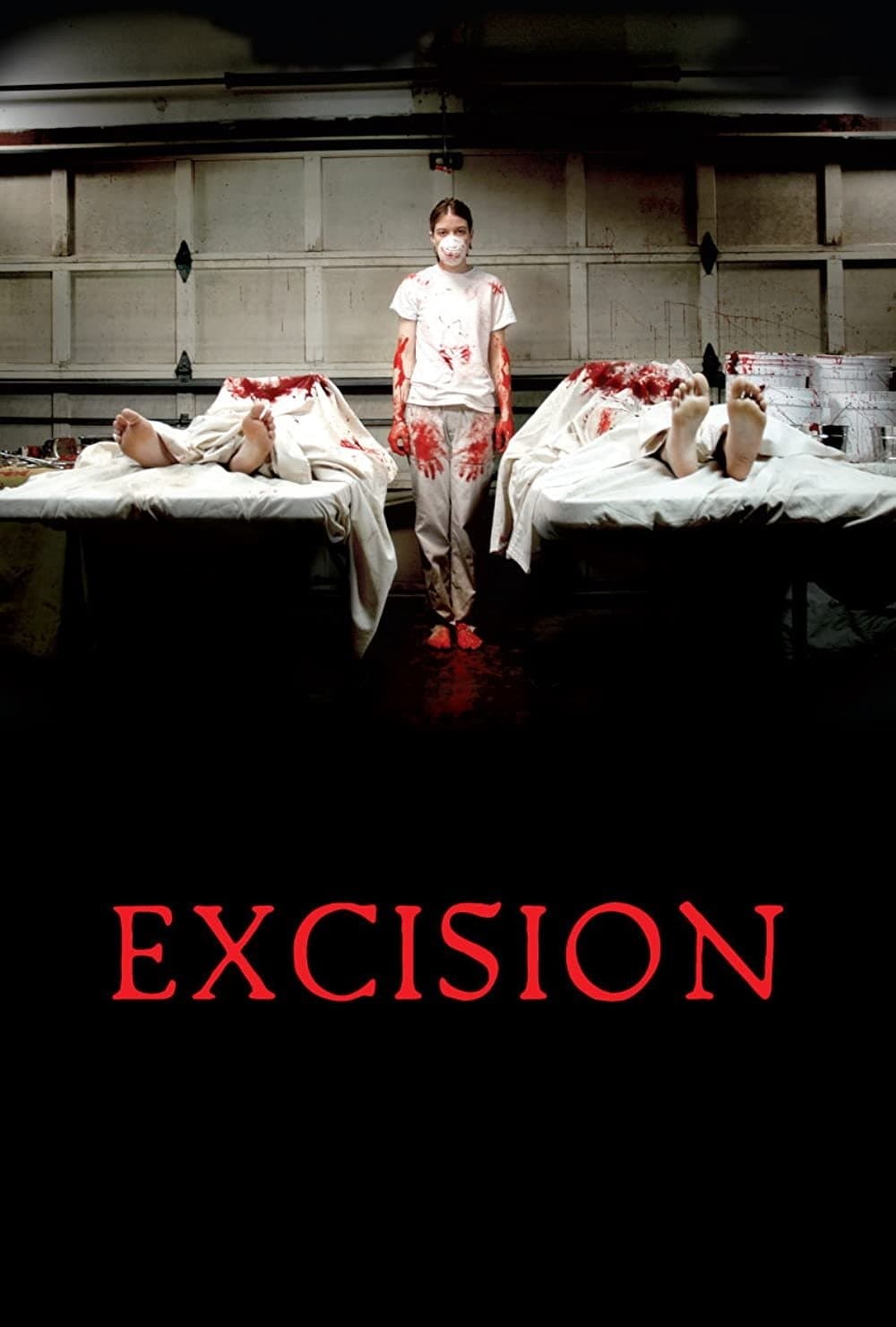 Excision photo