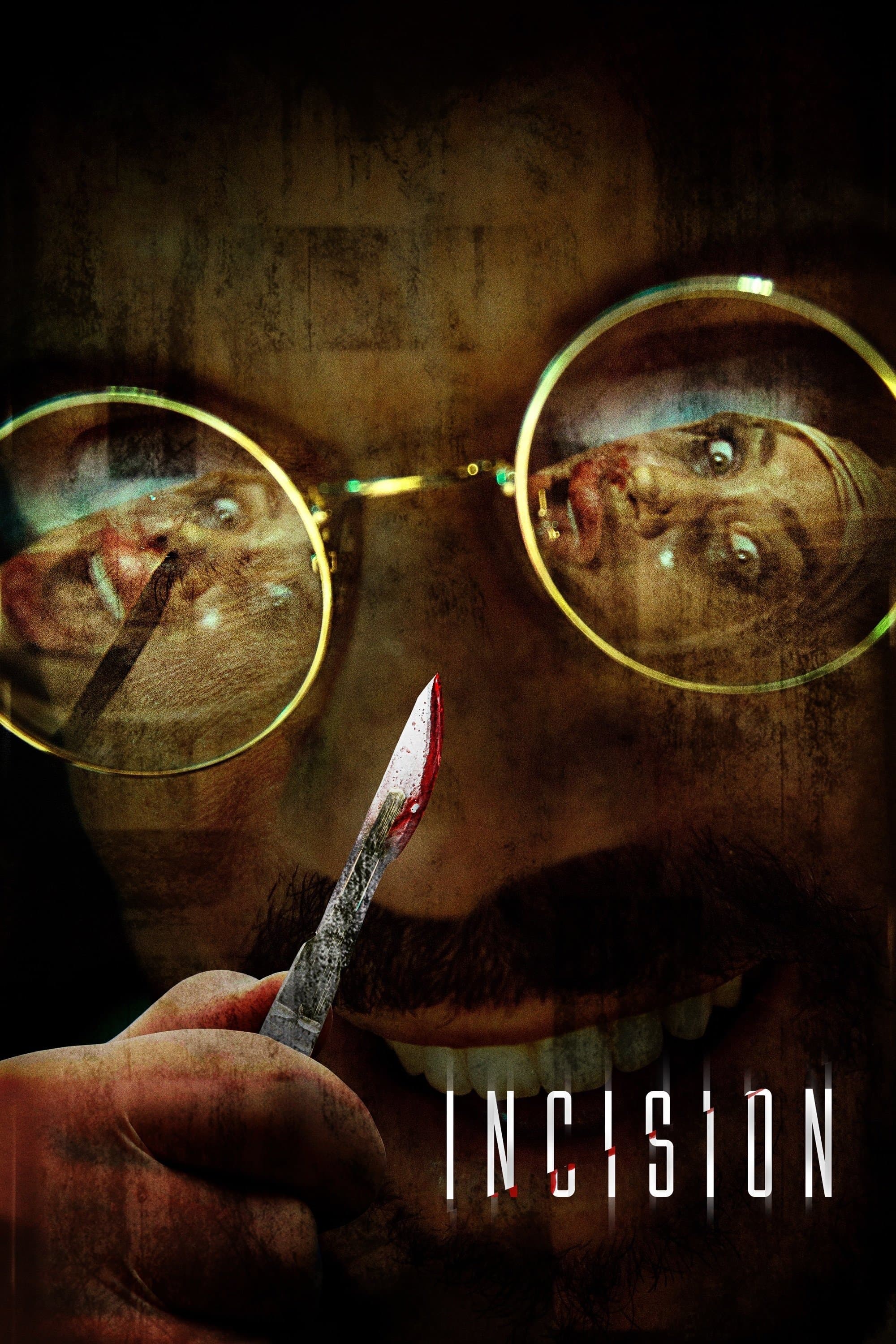 Incision photo
