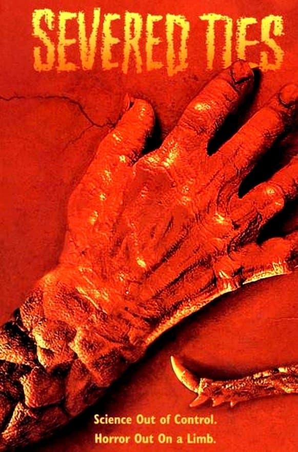 Severed Ties photo