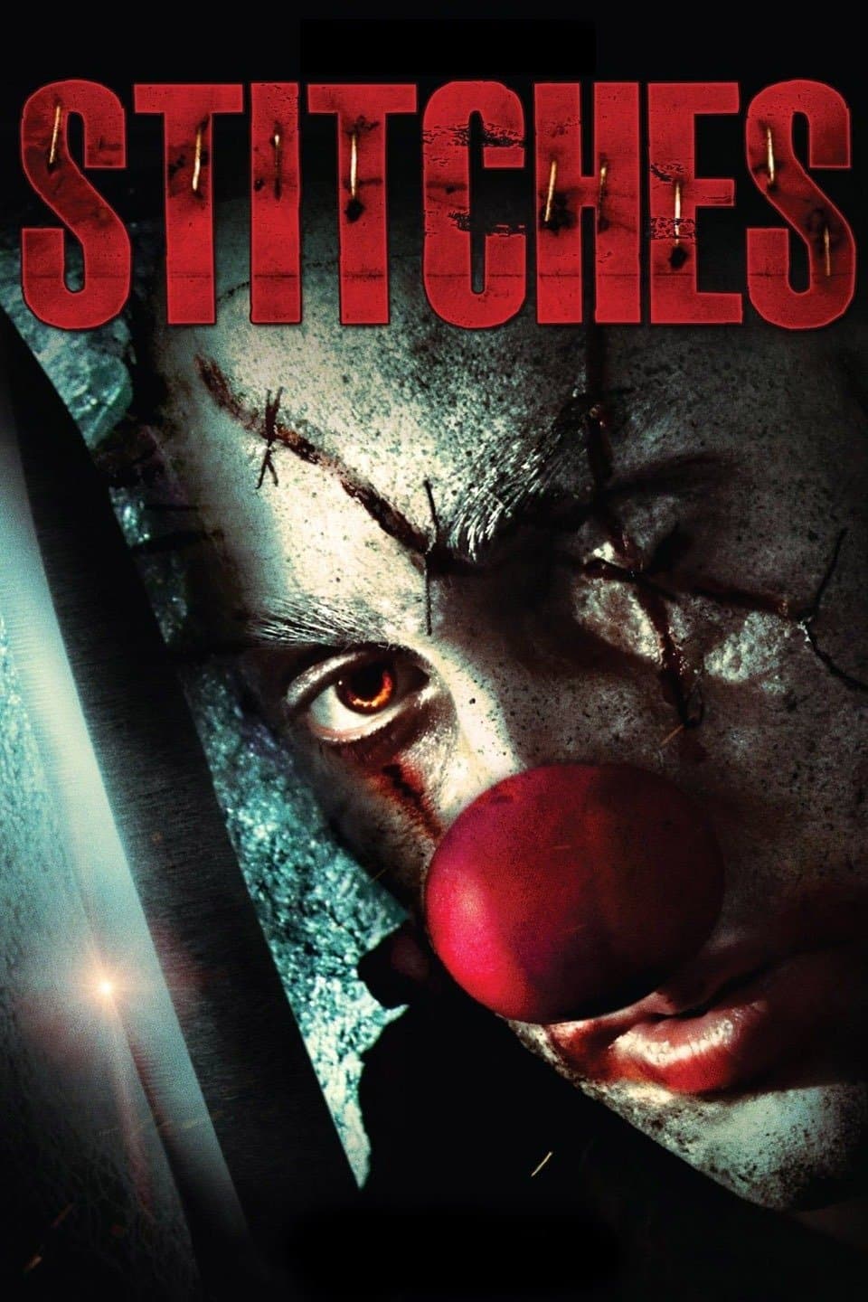 Stitches photo