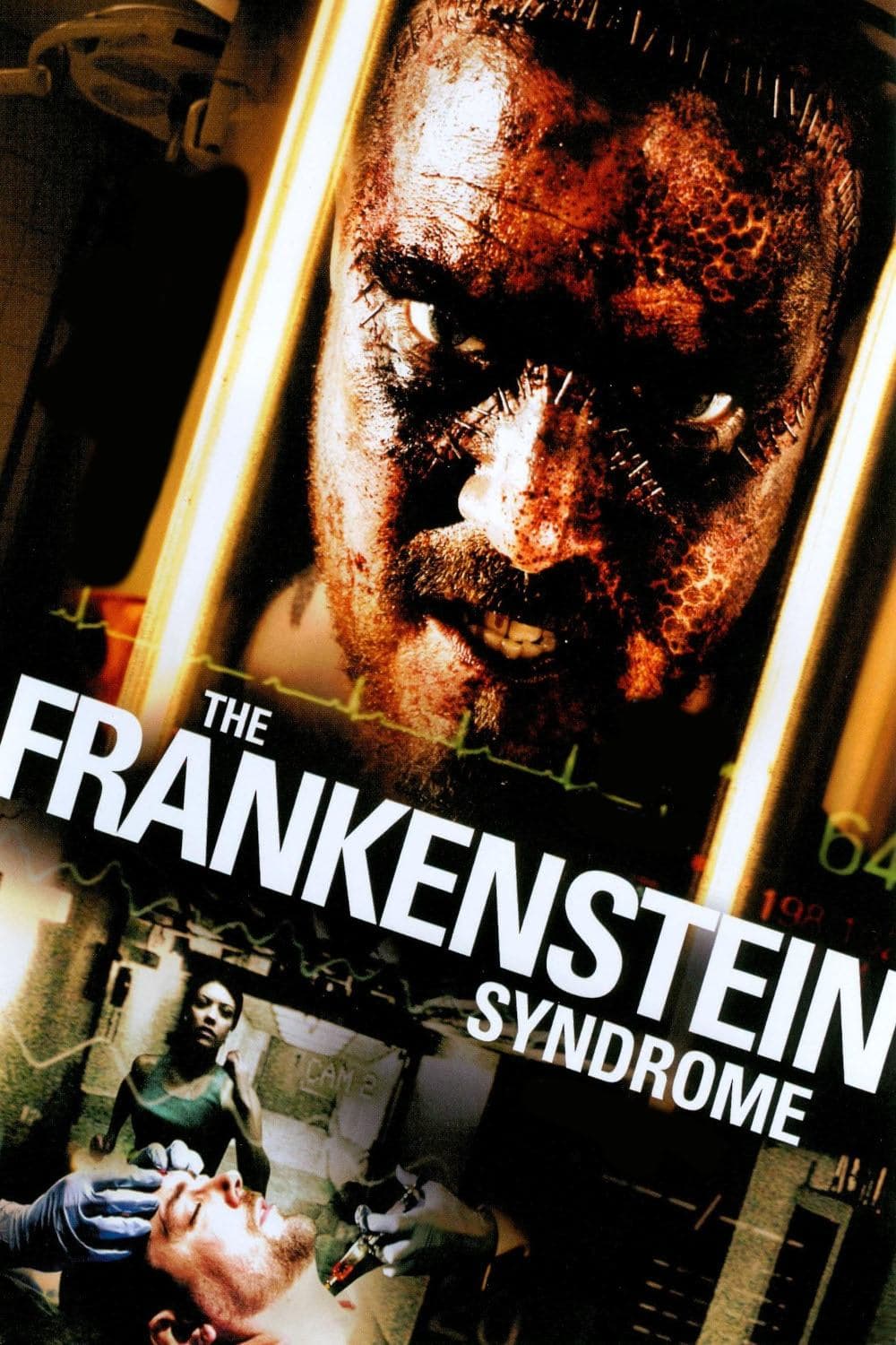 The Frankenstein Syndrome photo