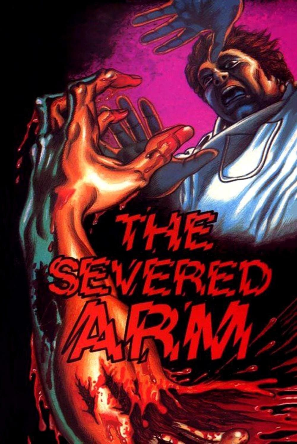The Severed Arm photo